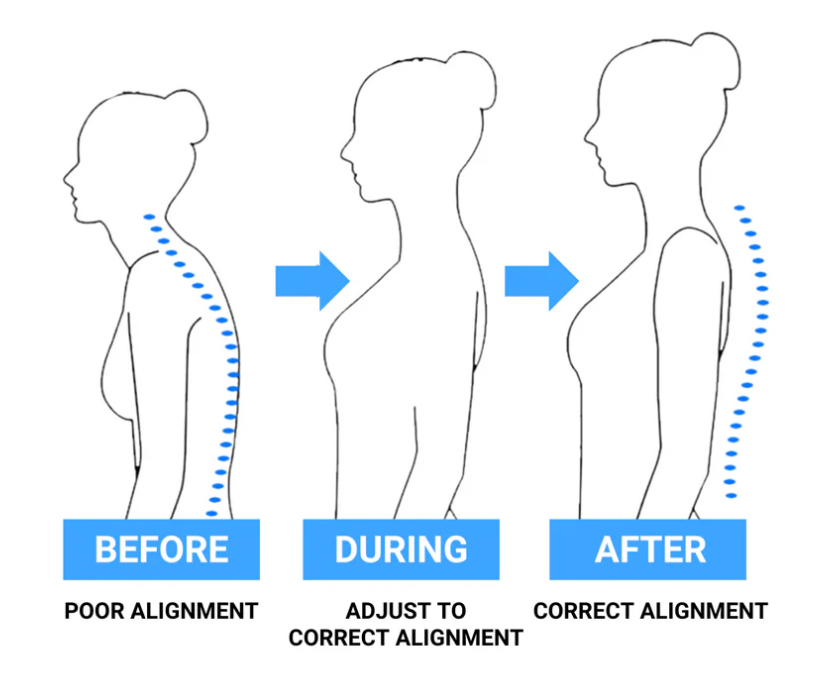 SpineGuard™ - Posture Alignment Trainer